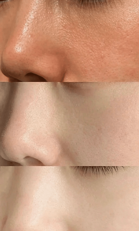 【美白針】試過一堆方法，還是去醫美打美白針最有效！皮膚嫩白超有感！ - 康橋診所-台中診所推薦