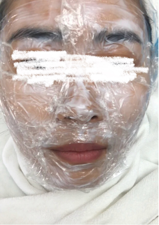 【皮秒雷射】長痘痘可以打皮秒雷射嗎？痘痘臉的皮秒雷射推薦！ - 康橋診所-台中診所推薦