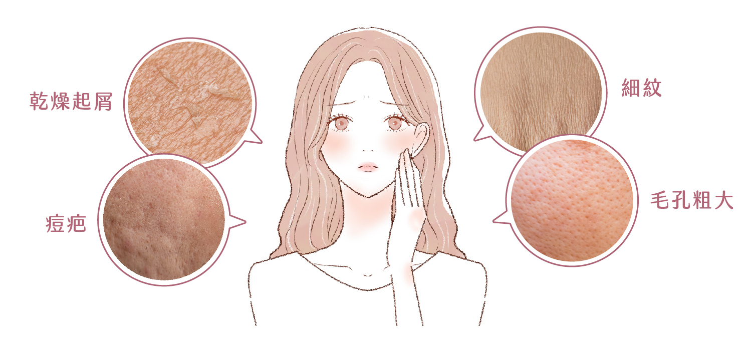 水光針深層補水 - 康橋診所-台中診所推薦