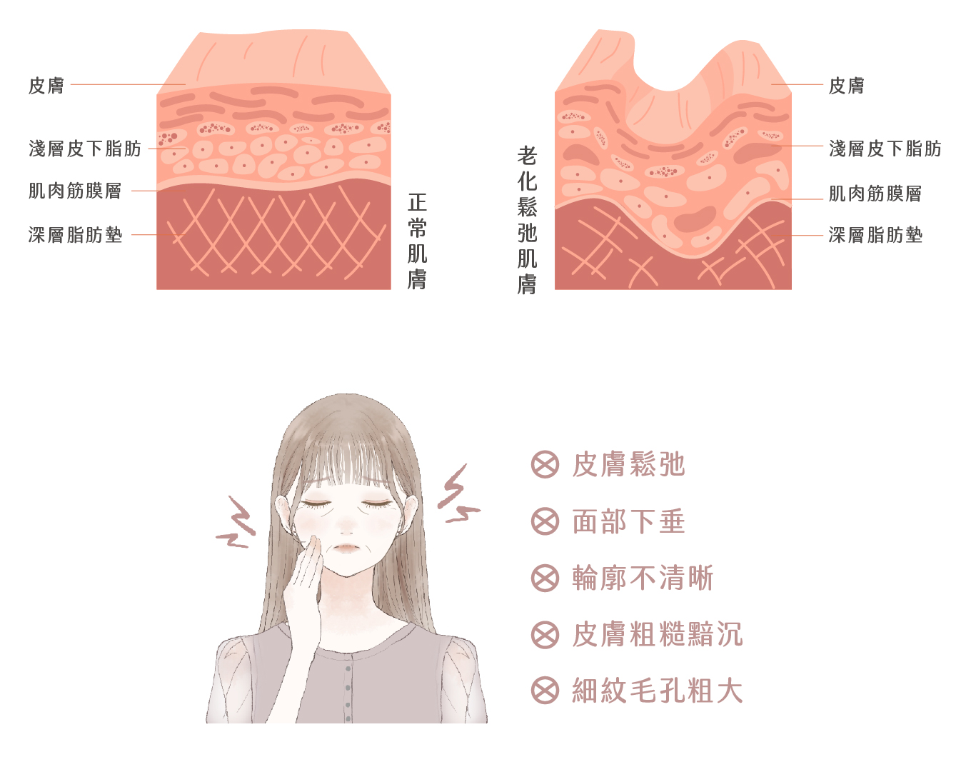 第四代MIT優芙納音波 - 康橋診所-台中診所推薦