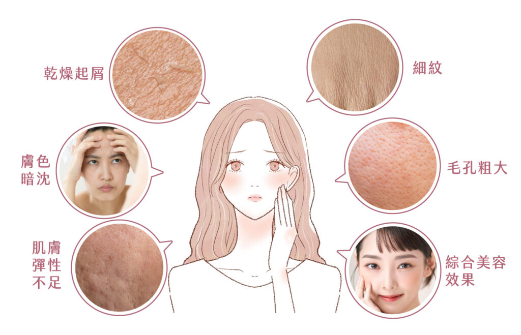 水光針／水光槍是什麼？水光針是很有效，但怎麼打才能降低水光針後遺症？ - 康橋診所-台中診所推薦