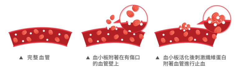 高濃度血小板血漿療法PRP - 康橋診所-台中診所推薦 五星評論診所 4 高濃度血小板血漿療法PRP - 康橋診所-台中診所推薦