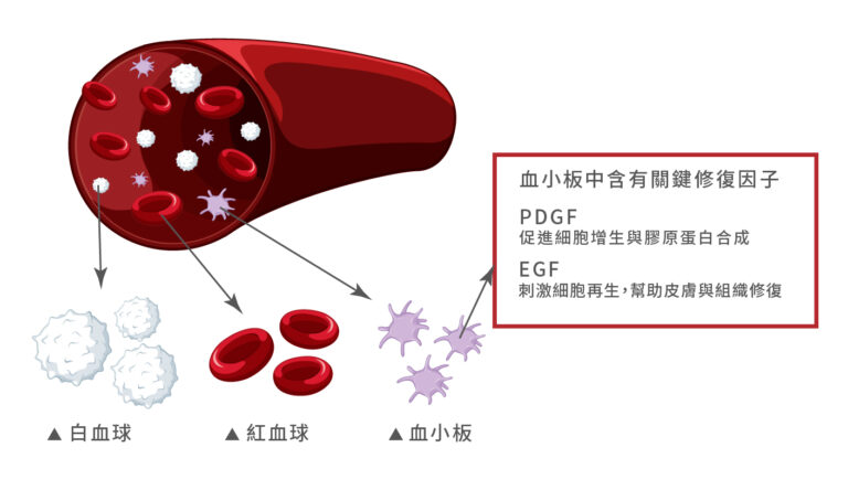 生長因子凍晶PLT - 康橋診所-台中診所推薦 五星評論診所 5 生長因子凍晶PLT - 康橋診所-台中診所推薦
