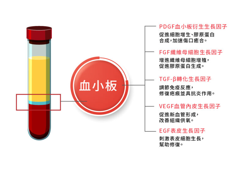 高濃度血小板血漿療法PRP - 康橋診所-台中診所推薦 五星評論診所 5 高濃度血小板血漿療法PRP - 康橋診所-台中診所推薦
