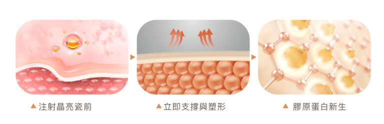 晶亮瓷 - 康橋診所-台中診所推薦 五星評論診所 6 晶亮瓷 - 康橋診所-台中診所推薦
