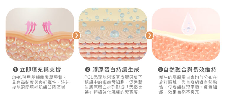 洢蓮絲少女針 - 康橋診所-台中診所推薦 五星評論診所 6 洢蓮絲少女針 - 康橋診所-台中診所推薦