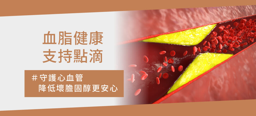 血脂健康支持點滴 - 康橋診所-台中診所推薦 五星評論診所 2 血脂健康支持點滴 - 康橋診所-台中診所推薦