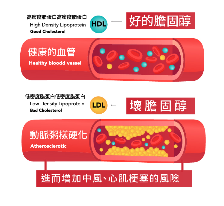 血脂健康支持點滴 - 康橋診所-台中診所推薦 五星評論診所 5 血脂健康支持點滴 - 康橋診所-台中診所推薦