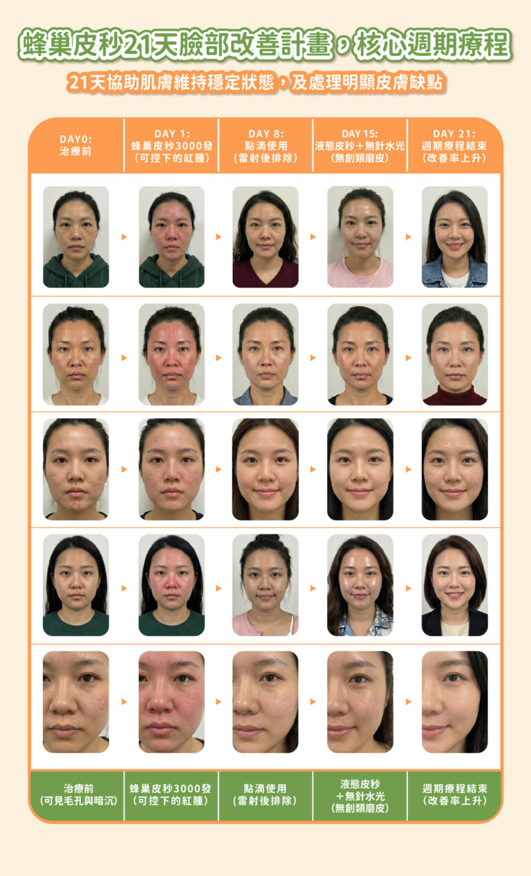 21天皮秒改善計劃 - 康橋診所-台中診所推薦