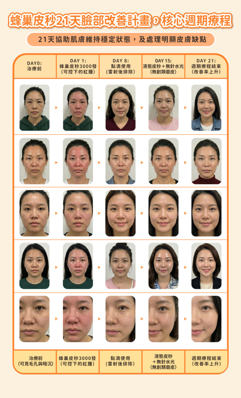 21天皮秒改善計劃 - 康橋診所-台中診所推薦